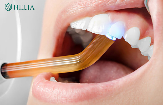 Trám răng thẩm mỹ - Phương pháp phục hình thẩm mỹ sử dụng vật liệu nhân tạo