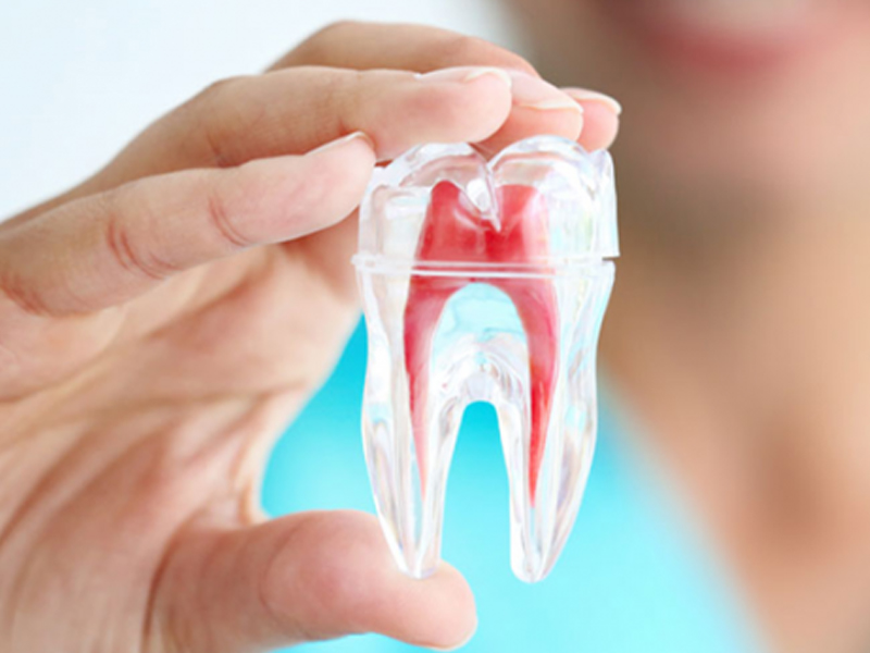 3 Nguyên tắc điều trị tủy răng
