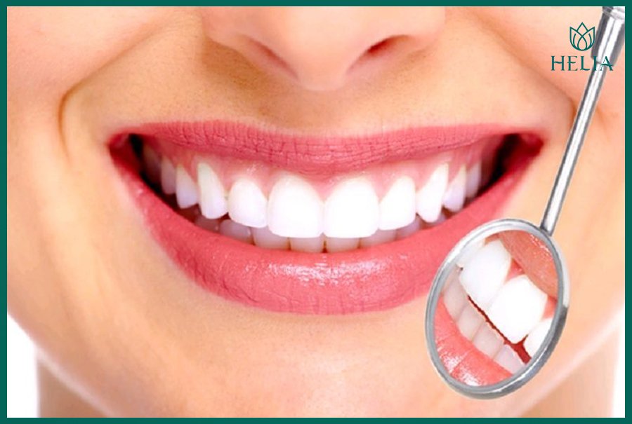 răng sứ kim loại sau 1 thời gian sẽ bị đen viền nướu